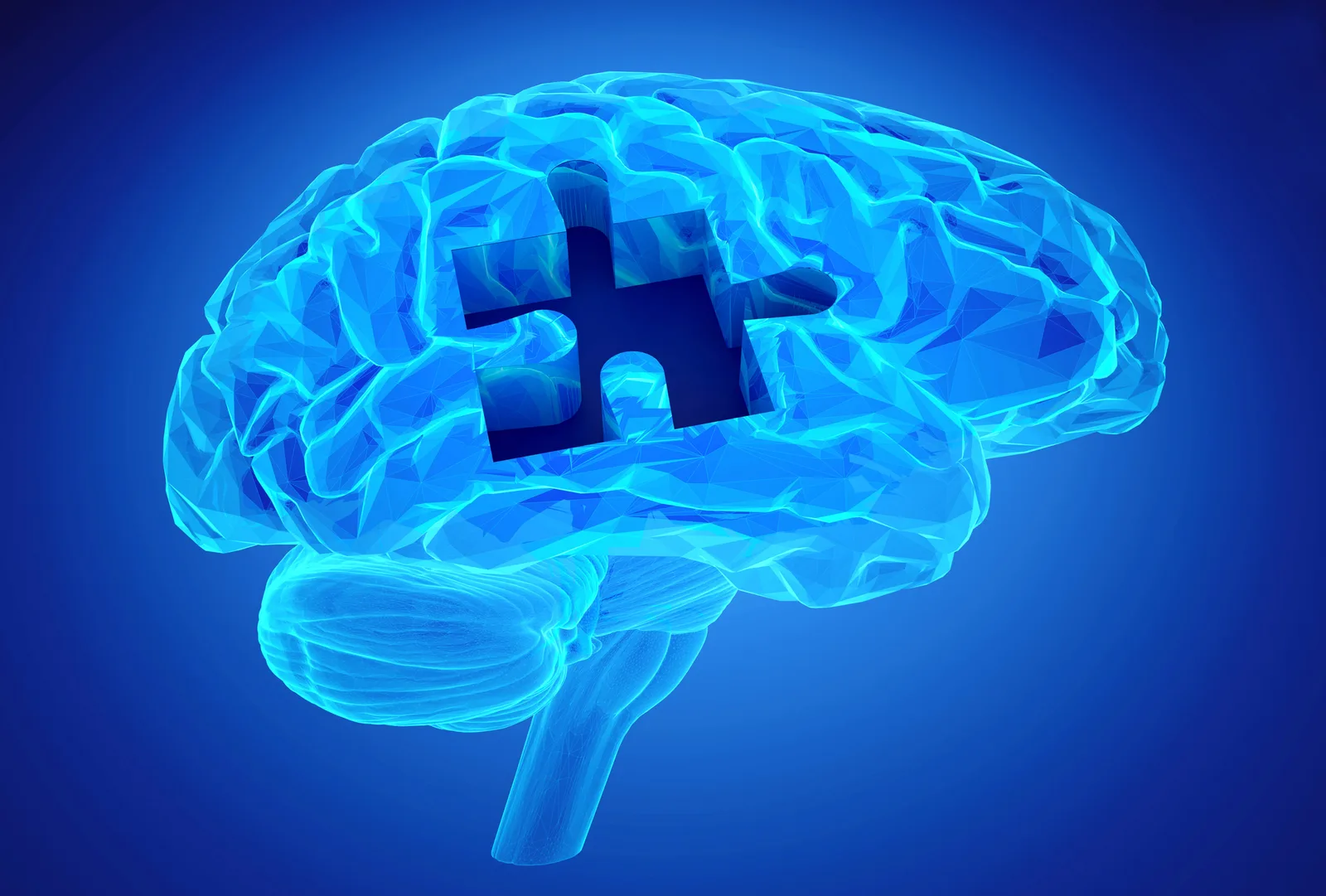 Blaue Illustration eines menschlichen Gehirns mit einem fehlenden Puzzleteil als Sinnbild für Alzheimer